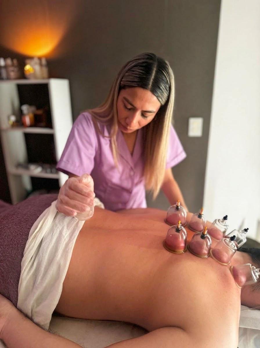 Terapia con Ventosas
